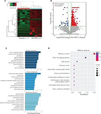 Serum exosomes lncRNAs: TCONS_I2_00013502 and ENST00000363624 are new diagnostic markers for rheumatoid arthritis